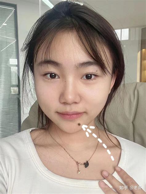 痦子位置解说图_痦子位置解说图女生,第16张 痦子位置解说图_痦子位置解说图女生,第16张