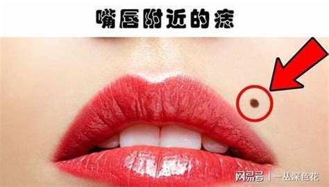女人下嘴唇后天长痣好不好_女人下嘴唇后天长痣代表什么,第6张