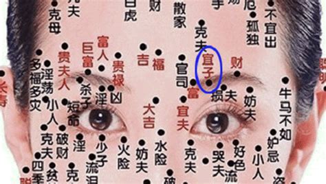 宜子痣是什么意思_宜子痣是什么意思女,第2张