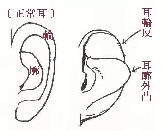 耳朵反骨面相_耳朵反骨面相解析,第2张