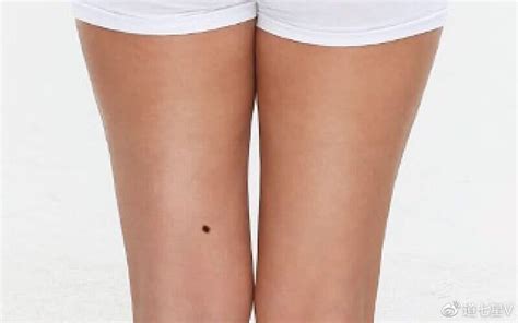 女人右腿根有痣代表什么_女人右腿根有痣是什么意思,第3张 女人右腿根有痣代表什么_女人右腿根有痣是什么意思,第3张