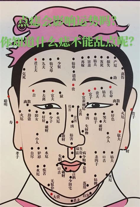 脸上哪些痣不能去掉示意图_脸上哪些痣必须点掉图解,第5张 脸上哪些痣不能去掉示意图_脸上哪些痣必须点掉图解,第5张