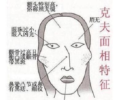 女人短命的十大征兆是什么_什么样的女人容易短命,第9张