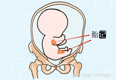 女人左乳房下有胎记好不好_女人左边乳房下胎记代表什么意思,第11张 女人左乳房下有胎记好不好_女人左边乳房下胎记代表什么意思,第11张