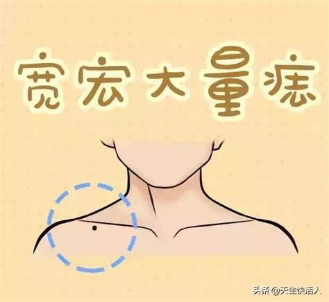 女人左乳房下有胎记好不好_女人左边乳房下胎记代表什么意思,第9张 女人左乳房下有胎记好不好_女人左边乳房下胎记代表什么意思,第9张