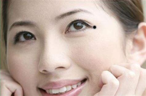 脸上哪些痣不能去掉示意图_脸上哪些痣必须点掉图解,第4张 脸上哪些痣不能去掉示意图_脸上哪些痣必须点掉图解,第4张