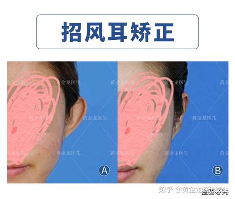 扇风耳男人什么命_扇风耳的男人命好不好,第6张