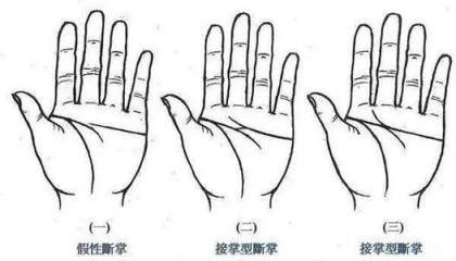 假断掌的男人的命运图_假断掌的男人的命运克六亲吗,第3张 假断掌的男人的命运图_假断掌的男人的命运克六亲吗,第3张