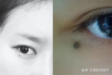 面部痣好坏一览表,痣相分析(详细),第12张 面部痣好坏一览表,痣相分析(详细),第12张
