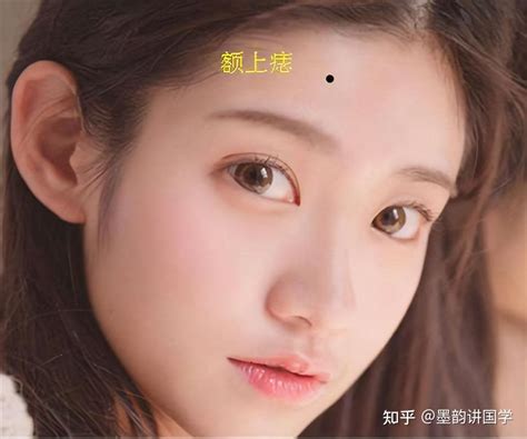 面部痣好坏一览表,痣相分析(详细),第13张 面部痣好坏一览表,痣相分析(详细),第13张