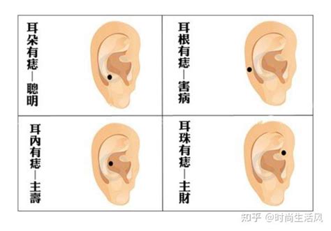 面部痣好坏一览表,痣相分析(详细),第19张 面部痣好坏一览表,痣相分析(详细),第19张