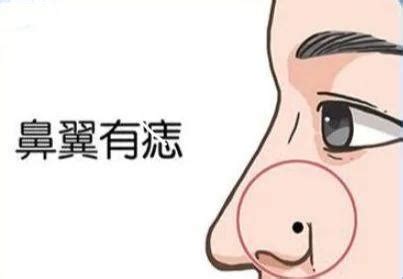 面部痣好坏一览表,痣相分析(详细),第20张 面部痣好坏一览表,痣相分析(详细),第20张