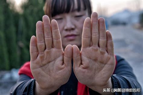 双手假断掌的男人的命运_两手假断掌的男人的命运,第7张