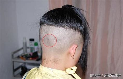 头发里长痣的位置图解_头发里长痣的位置图解男,第7张 头发里长痣的位置图解_头发里长痣的位置图解男,第7张