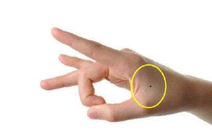 女人左手虎口有痣好不好_女人左手虎口有痣该不该去掉,第14张 女人左手虎口有痣好不好_女人左手虎口有痣该不该去掉,第14张