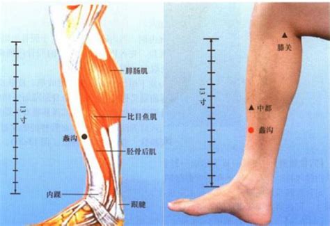 大腿上有胎记代表什么_大腿上有胎记好不好,第6张