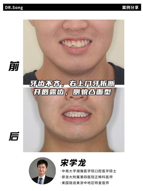 看面相怎么看财运好坏_面相如何看财运好不好,第6张