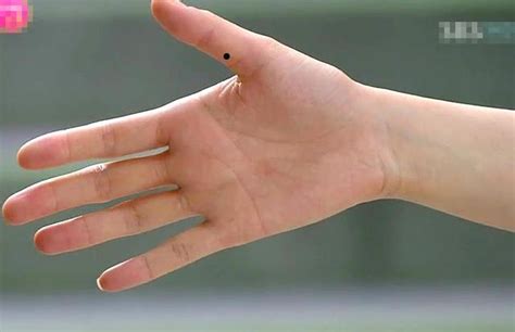 右手食指第一关节有痣代表什么意思_右手食指第一关节有痣代表什么意义,第8张