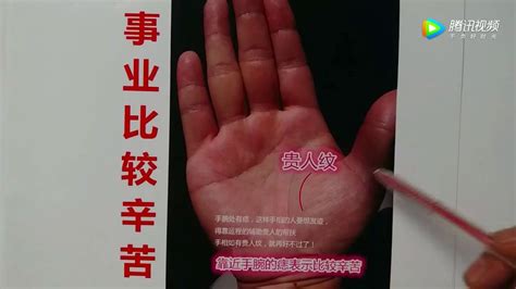 手掌有痣图解大全_手掌有痣代表什么意思,第8张 手掌有痣图解大全_手掌有痣代表什么意思,第8张