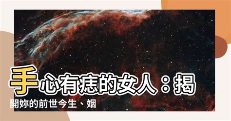 手掌有痣图解大全_手掌有痣代表什么意思,第8张