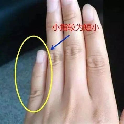 小拇指短代表什么意思_小拇指短有什么说法,第12张 小拇指短代表什么意思_小拇指短有什么说法,第12张