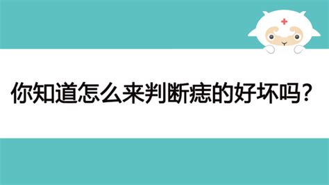 面部10处恶痣是什么必须点掉_脸部哪里的痣不能点,第4张