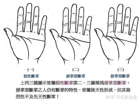 男孩左手断掌父亲会早死，这种说法科学吗?,第9张