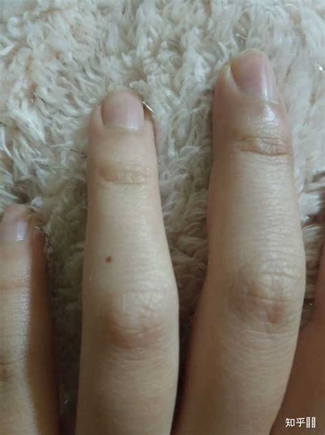 右手食指第一关节有痣代表什么意思_右手食指第一关节有痣代表什么意义,第11张