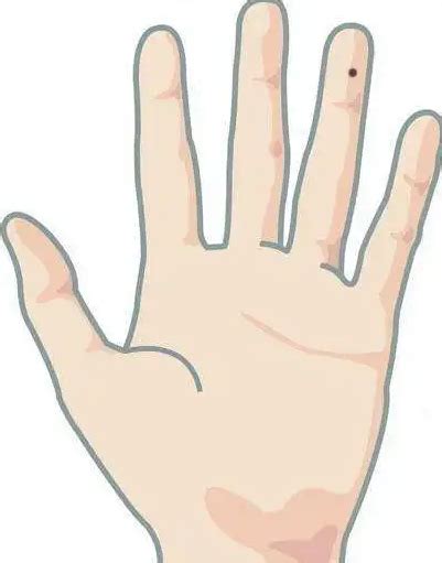 手掌心的胎记代表什么_手心长胎记有什么寓意,第9张 手掌心的胎记代表什么_手心长胎记有什么寓意,第9张