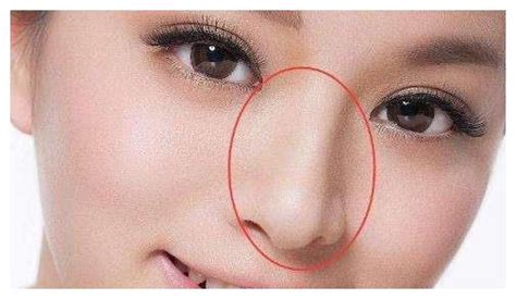 五种富贵鼻是哪五种_鼻子看相:五种富贵鼻,第11张 五种富贵鼻是哪五种_鼻子看相:五种富贵鼻,第11张