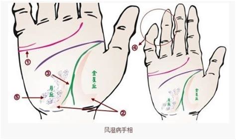 罕见的掌心三角形代表什么_罕见的掌心三角形是什么,第15张