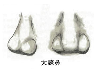 蒜头鼻漂亮女生_蒜头鼻漂亮女明星,第3张