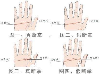 假断掌的男人的命运图_假断掌的男人的命运克六亲吗,第4张 假断掌的男人的命运图_假断掌的男人的命运克六亲吗,第4张