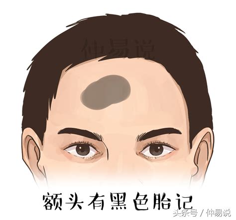 什么地方的胎记旺桃花_胎记长在什么地方犯桃花,第4张 什么地方的胎记旺桃花_胎记长在什么地方犯桃花,第4张