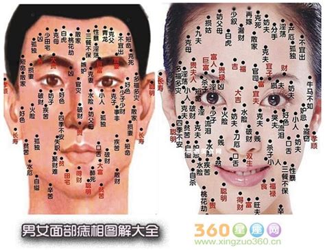女人10处有痣是富贵痣苦命痣_男人10处有痣是富贵痣痣相学分析,第30张 女人10处有痣是富贵痣苦命痣_男人10处有痣是富贵痣痣相学分析,第30张