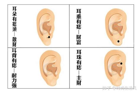 朱砂痣是什么颜色_朱砂痣是什么样子,第4张 朱砂痣是什么颜色_朱砂痣是什么样子,第4张