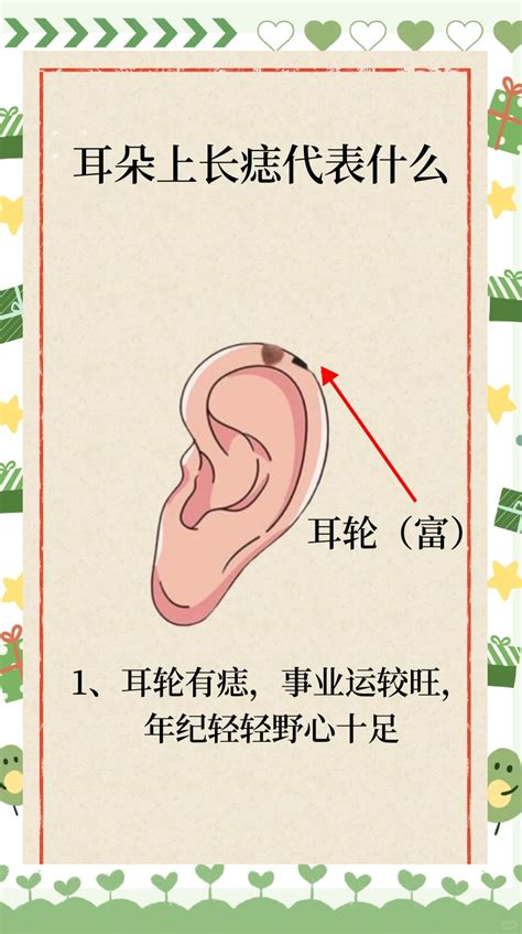 面部痣好坏一览表图片_面部痣好坏一览表左右,第17张 面部痣好坏一览表图片_面部痣好坏一览表左右,第17张