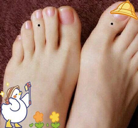 脚上长痣图解大全_脚上长痣图解大全女性,第6张 脚上长痣图解大全_脚上长痣图解大全女性,第6张