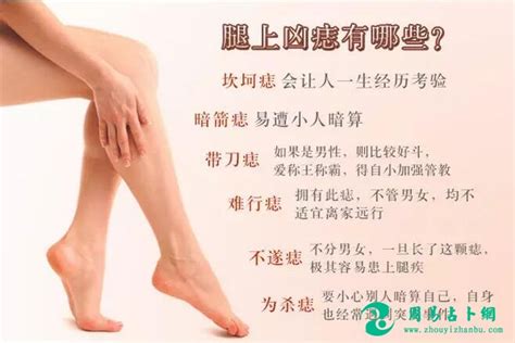 大腿上有胎记代表什么_大腿上有胎记好不好,第8张