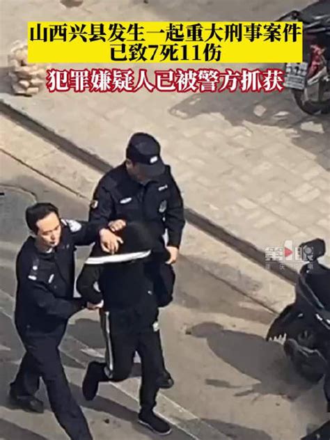 发中的胎记说明了什么_发中有胎记有什么寓意,第6张 发中的胎记说明了什么_发中有胎记有什么寓意,第6张