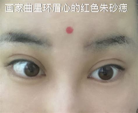 朱砂痣是什么颜色_朱砂痣是什么样子,第3张 朱砂痣是什么颜色_朱砂痣是什么样子,第3张